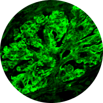C3 IG Deposits Graphic