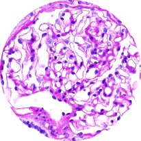 Healthy glomeruli graphic