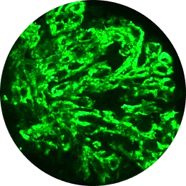 Ig Dominant Deposits 1 Graphic